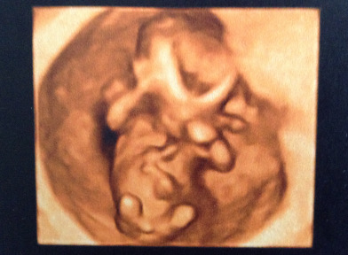 bébé à 3 mois de grossesse en 3D